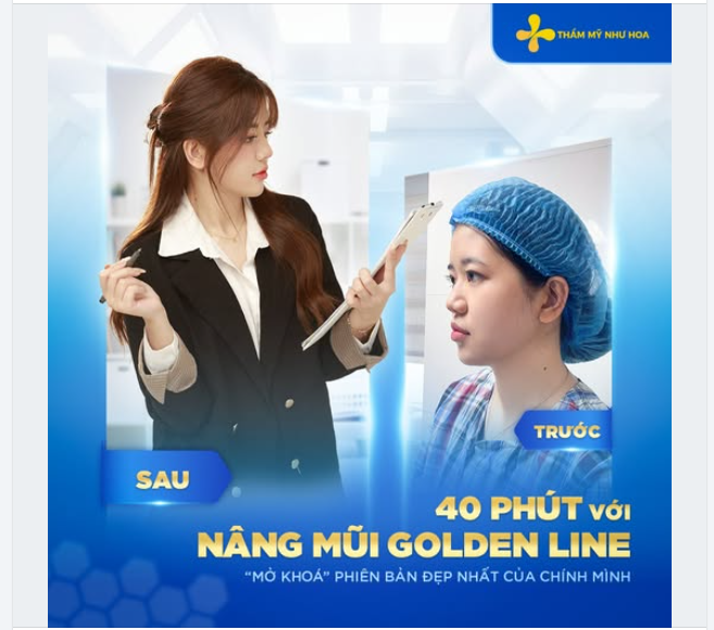 Nâng mũi Golden Line tại Thẩm mỹ Như Hoa – 40 phút cho một kết quả chuẩn xác