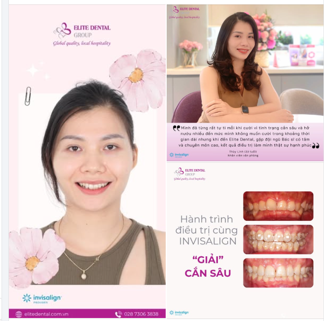 HÀNH TRÌNH “GIẢI CẮN SÂU” VỚI NIỀNG RĂNG TRONG SUỐT CÙNG ELITE DENTAL