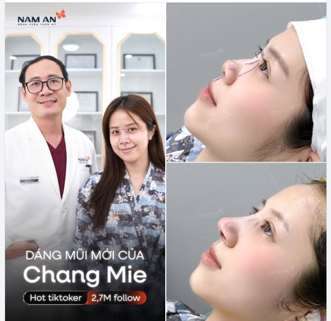 DÁNG MŨI MỚI CỦA CHANG MIE - SẮT NÉT CÓ ĐIỂM NHẤN