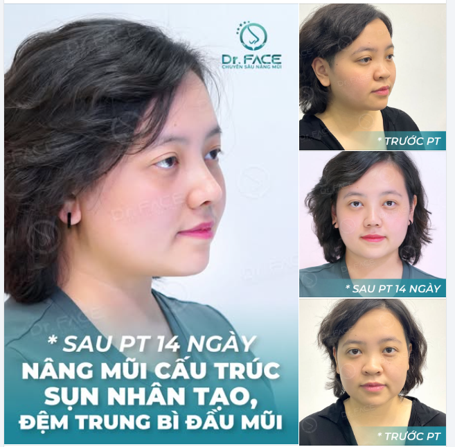 MỘT LẦN SAI, CẢ ĐỜI NHỚ – MAY LÀ CÒN KỊP SỬA