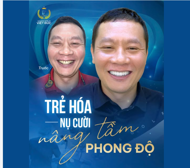 NỤ CƯỜI MỚI, PHONG ĐỘ MỚI!