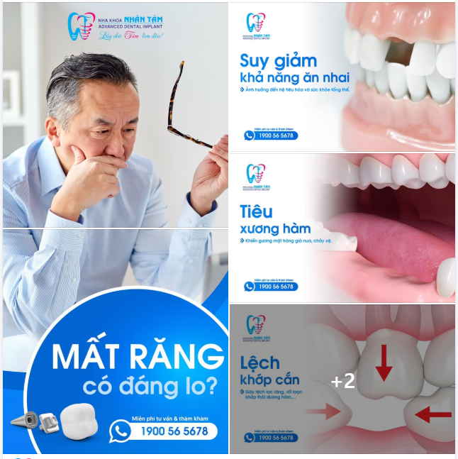 MẤT RĂNG CÓ ĐÁNG LO?