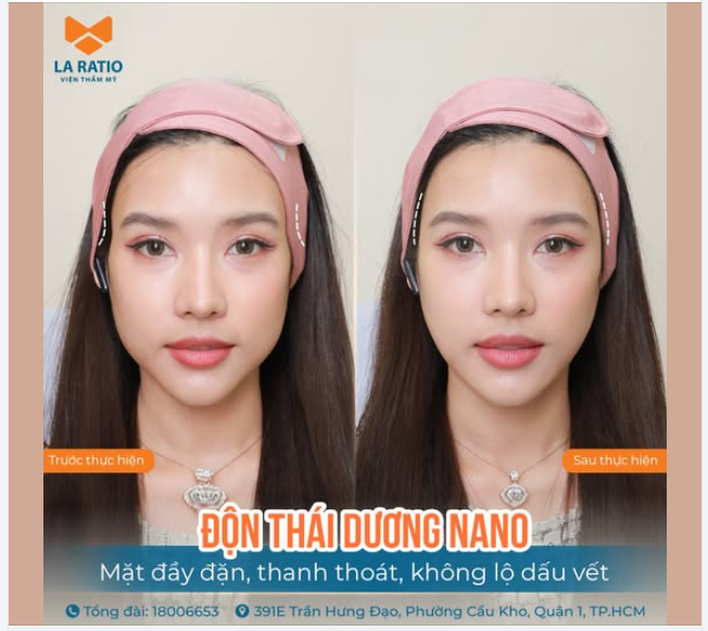 ĐỘN THÁI DƯƠNG NANO SINH HỌC – GƯƠNG MẶT ĐẦY ĐẶN, THANH THOÁT MÀ KHÔNG LỘ DẤU VẾT
