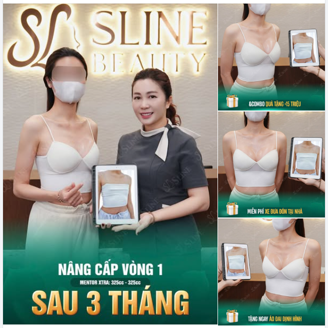 FEEDBACK V1 - SAU 3 THÁNG : Đẹp đến “mê mẩn”!