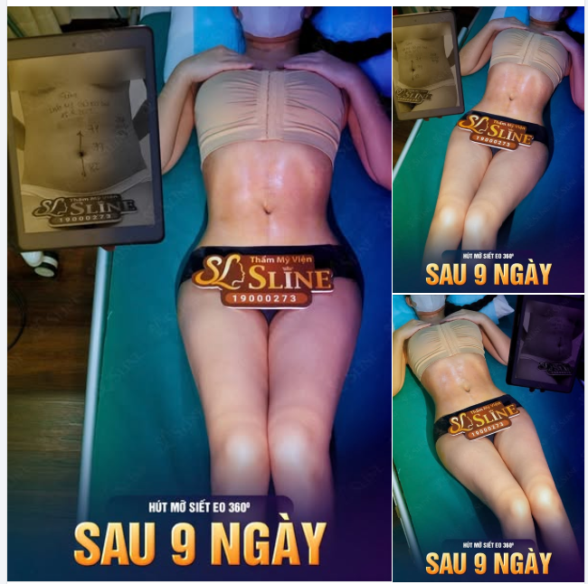 Ở ĐÂY! CHỈ CÓ SỰ THẬT!  Quảng cáo đâu cũng có, nhưng feedback từ khách hàng thật mới là “vũ khí” khiến người ta tin & chọn HÚT MỠ SIẾT EO 360 với Sline.
