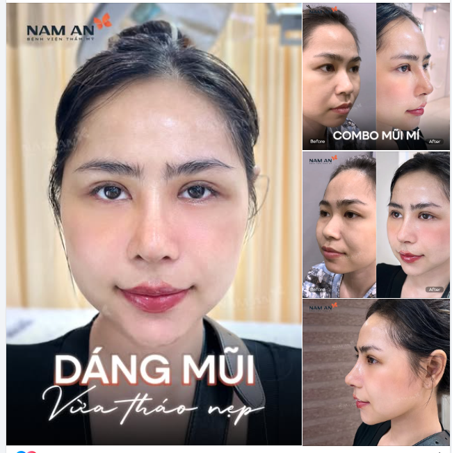 GẤP ĐÔI VISUAL VỚI COMBO MŨI MÍ.