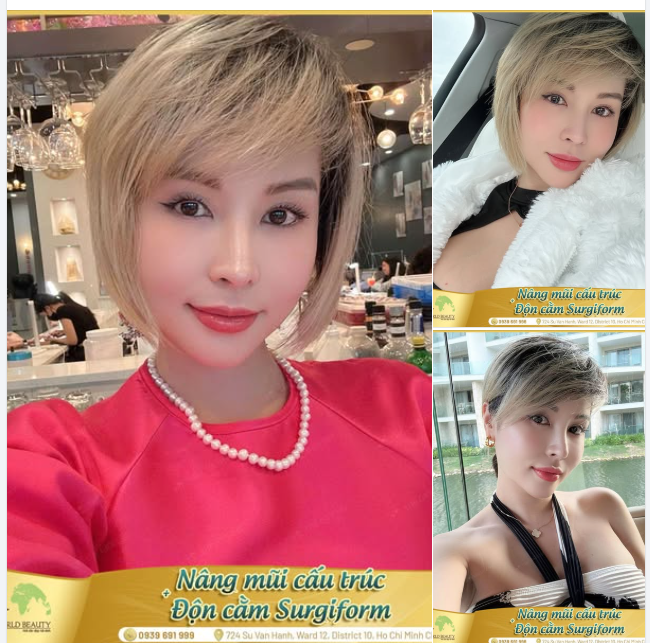 “Cám ơn Bác Phùng giùm Chị nha, 1 chiếc mũi 7 năm đi đâu ai cũng khen vẫn còn đẹp, chiếc cằm 2 năm rất tự nhiên không nói không ai biết luôn”