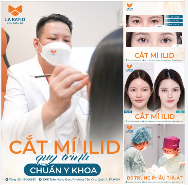 Cắt mí ILID chuẩn y khoa – Giải pháp hoàn hảo cho đôi mắt cuốn hút