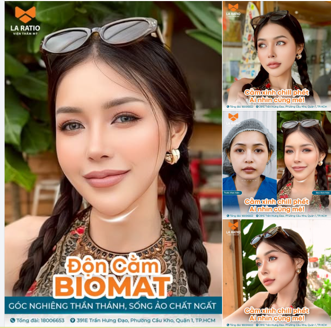 Độn cằm Bio Mat – Bí Quyết Tạo Khuôn Mặt Vline Thon Gọn, Không Lo Lộ Cằm Giả