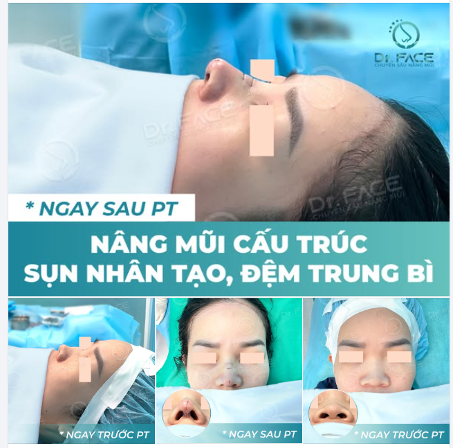 TRƯỚC–SAU KHÁC GÌ ĐÂU… KHÁC TOÀN BỘ CHỨ CÒN GÌ