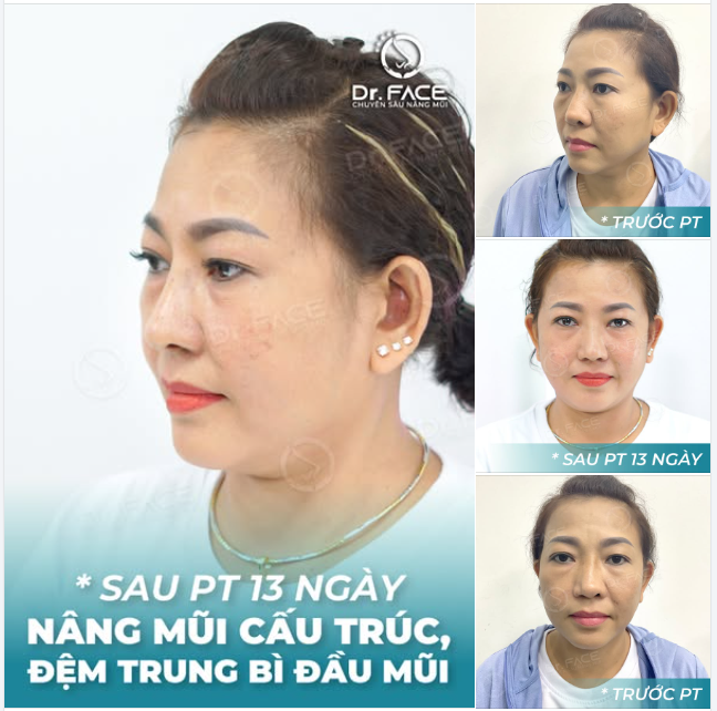 THẤT BẠI 9 LẦN, LẦN THỨ 10 AI CŨNG KHEN LÀ LẦN ĐẸP NHẤT