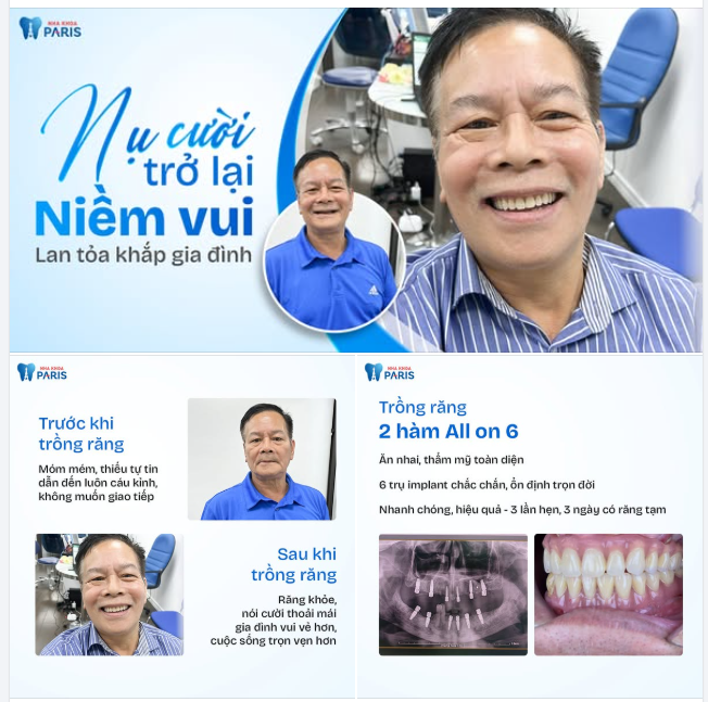 Nụ cười trở lại, niềm vui lan toả khắp gia đình  Chú Thắng đã sống với hàm răng móm mém gần chục năm.