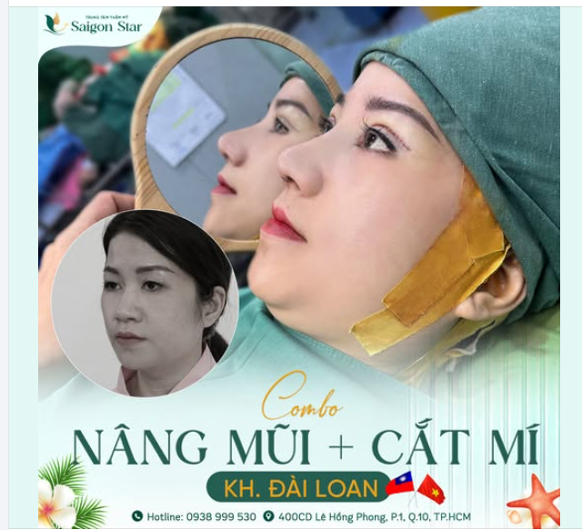 Chị Trúc Giang (Đài Loan) chia sẻ sau 90 phút NÂNG MŨI CẤU TRÚC + CẮT MẮT 2 MÍ