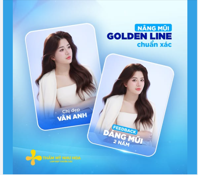 2 năm trôi qua, dáng mũi Golden Line của chị đẹp Vân Anh form luôn đẹp, hài hòa với gương mặt – minh chứng cho tay nghề chuẩn xác của Tiến sĩ Tống Hải.