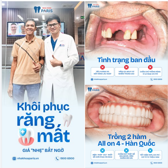 Trồng răng không còn là xa xỉ  Đúng chỗ – đúng cách – là "nhẹ bất ngờ"