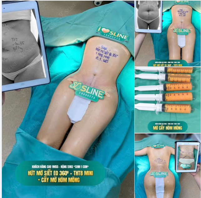 COMBO “ĐIÊU KHẮC BODY” – GÓI CHUYỂN MÌNH TOÀN DIỆN VỚI SLINE
