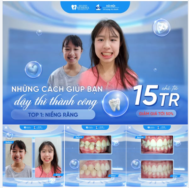 TOP NHỮNG CÁCH GIÚP BÉ DẬY THÌ THÀNH CÔNG