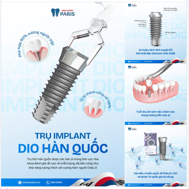 Trụ DIO Hàn Quốc - Giải pháp tối ưu cho tình trạng mất răng của người Việt