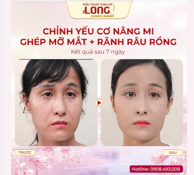 OK khách yêu luôn nha. Bác chốt liền combo trẻ đẹp tự nhiên.