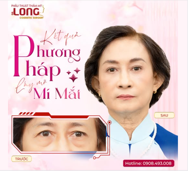 KẾT QUẢ CỦA VIỆC “TRÚT BỎ” GÁNH NẶNG LÀ NHƯ THẾ NÀO?