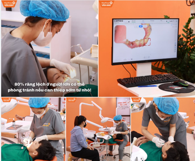 80% vấn đề răng lệch lạc ở người lớn hoàn toàn có thể được phòng tránh nếu can thiệp đúng thời điểm khi còn nhỏ!