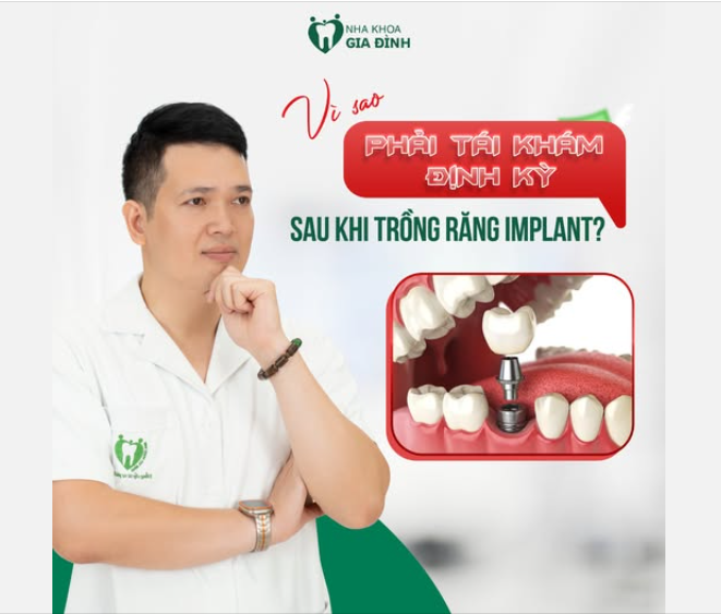 TẠI SAO PHẢI TÁI KHÁM ĐỊNH KỲ SAU KHI TRỒNG RĂNG IMPLANT?
