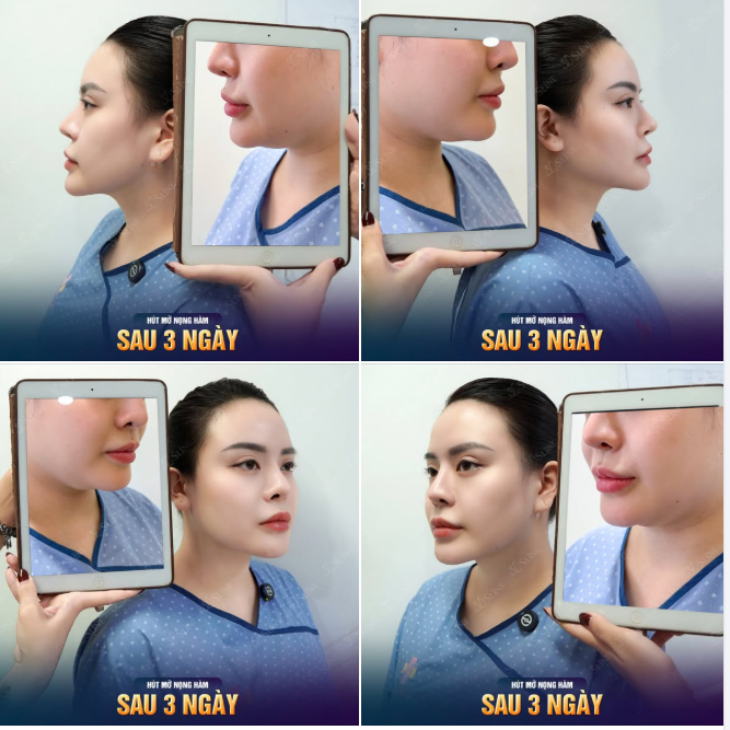 TẠM BIỆT NỌNG HÀM