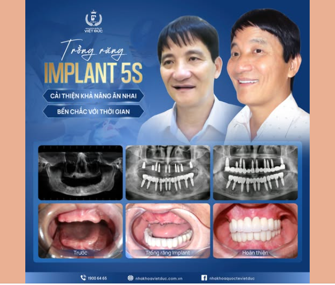 NỤ CƯỜI TIỀN TỶ” VÀ SỰ THẬT ĐẰNG SAU – CÂU CHUYỆN CẢ ĐỜI CỦA CHÚ VŨ NGỌC BÍCH