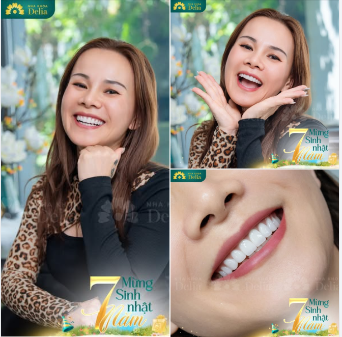 Mình từng nghĩ sẽ chẳng bao giờ tự tin cười thật tươi, cho đến khi làm răng sứ xong" - Chị Kim hạnh phúc chia sẻ.