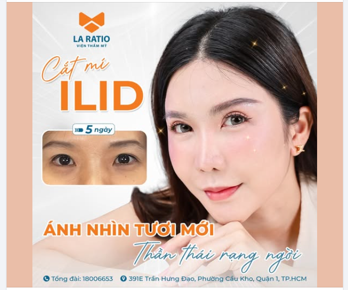 Cắt mí ILID đẹp chỉ sau 5 ngày – Lựa chọn đúng đắn của phụ nữ sau 30