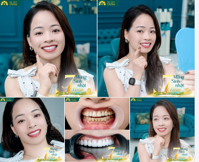 Một nụ cười đẹp – thay đổi cả gương mặt, nâng tầm khí chất!