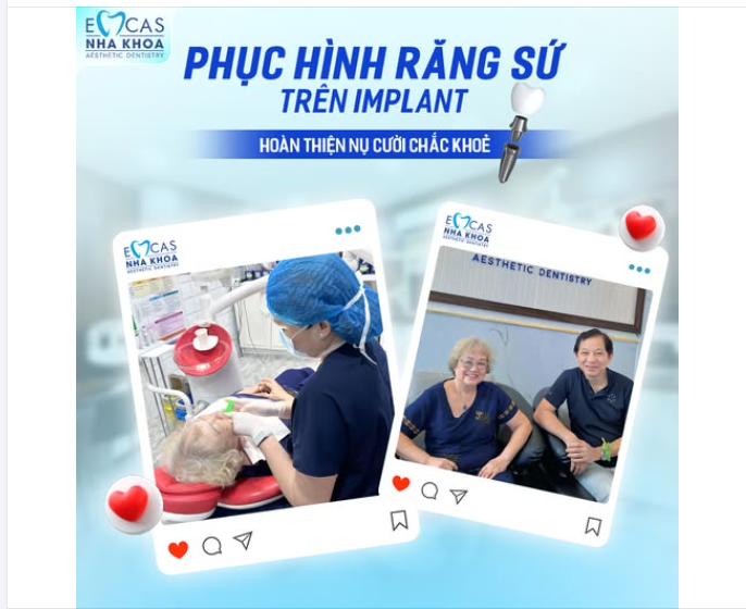 PHỤC HÌNH RĂNG SỨ TRÊN IMPLANT  HOÀN THIỆN NỤ CƯỜI CHẮC KHỎE