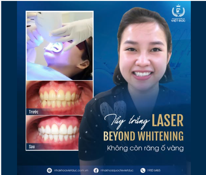 BẠN MUỐN RẠNG RỠ VỚI NỤ CƯỜI TRẮNG SÁNG CÒN CHỜ GÌ MÀ KHÔNG TẨY TRẮNG RĂNG ĐI