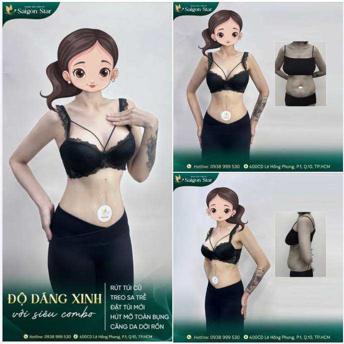 ĐỘ DÁNG SIÊU XINH CÙNG SIÊU COMBO NHÀ DR. HOẠT