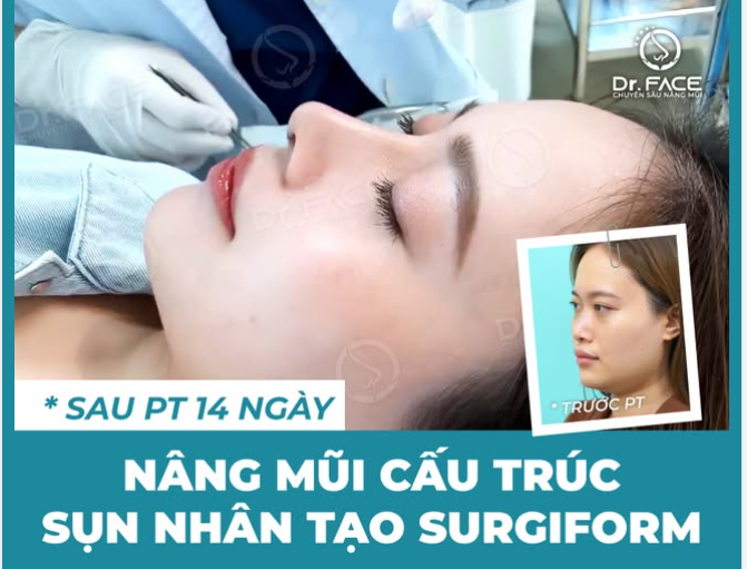 CHỤP VỘI mà cứ tưởng MẪU QUAY TVC á trời!