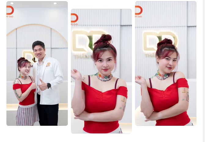 Khách hàng check in sau 2 năm Nâng mũi + Cắt mí tại DrD: Mũi đỉnh - Mí nét - Thần thái khỏi “bàn”