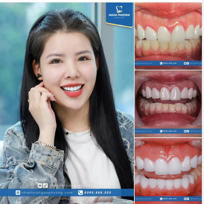 Trả lại nụ cười rạng rỡ cho chị Vân Anh