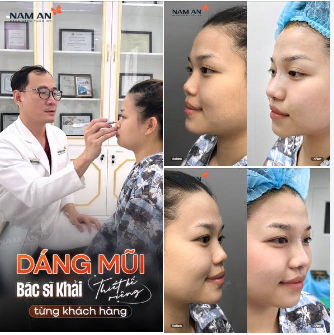 Mỗi dáng mũi – Một thiết kế riêng biệt!