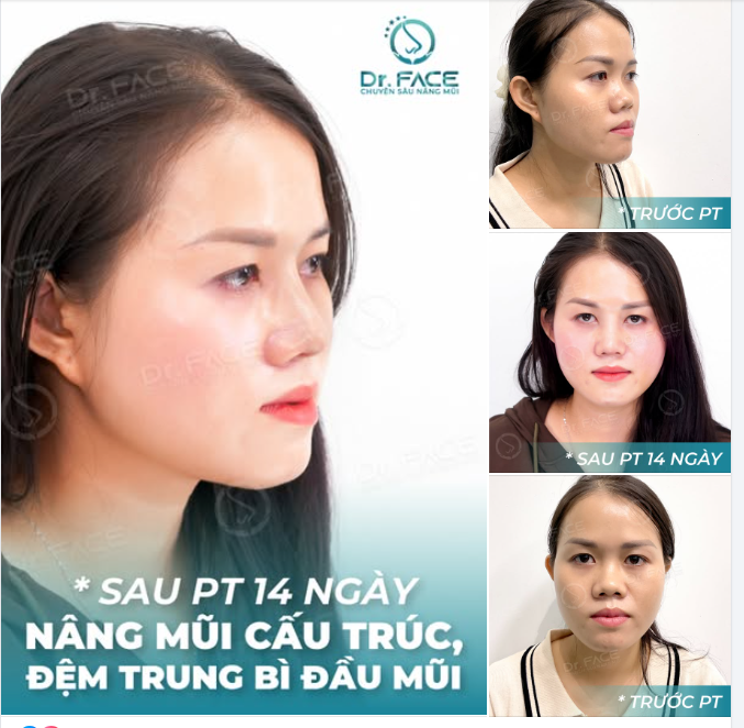DÁNG MŨI DÀNH RIÊNG CHO CÔ GIÁO