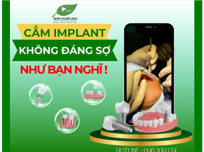 CẮM GHÉP IMPLANT – KHÔNG HỀ ĐÁNG SỢ NHƯ BẠN NGHĨ!