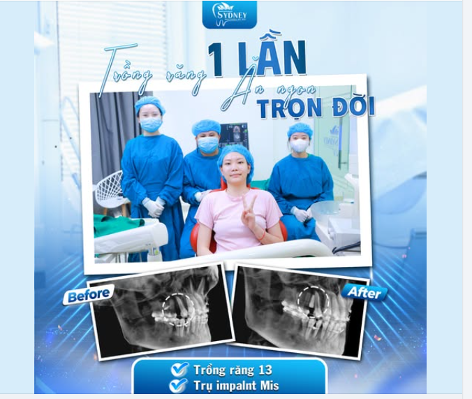 TRỒNG RĂNG 1 LẦN - ĂN NGON TRỌN ĐỜI