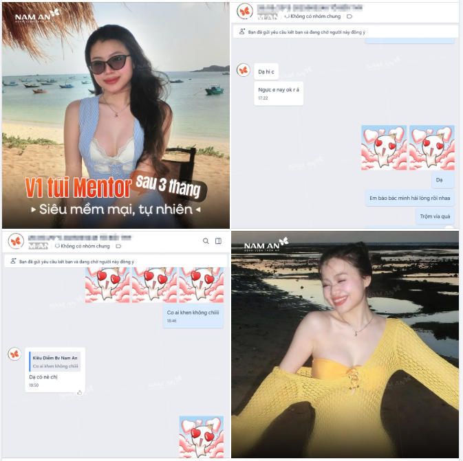 3 THÁNG SAU NÂNG NGỰC: VÒNG 1 CĂNG TRÒN – MỀM MẠI – SIÊU TỰ NHIÊN