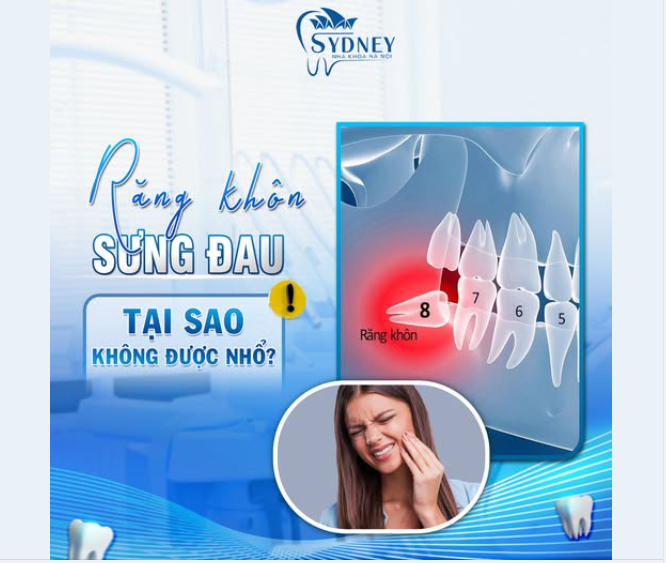 RĂNG KHÔN SƯNG ĐAU - TẠI SAO KHÔNG ĐƯỢC NHỔ?