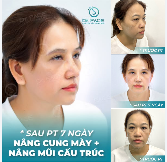 KHÔNG TÌM LẠI TUỔI TRẺ – CHỈ TÌM LẠI CHÍNH MÌNH
