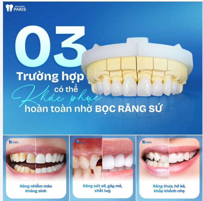 3 tình trạng răng có thể khắc phục hoàn toàn nhờ BỌC RĂNG SỨ