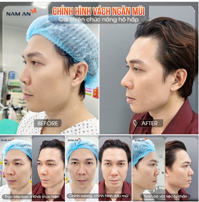 Nhưng tiêu chuẩn chung tại bác sĩ Khải là: an toàn, vững bền và phù hợp lâu dài