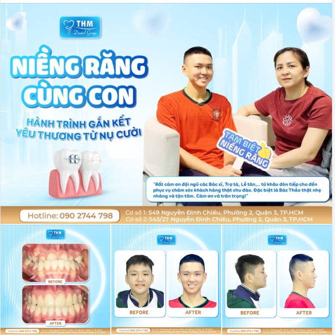 NIỀNG RĂNG CÙNG CON - HÀNH TRÌNH GẮN KẾT YÊU THƯƠNG TỪ NỤ CƯỜI
