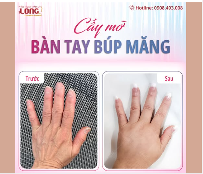 THÔ GẦY HÓA ĐẦY ĐẶN MỊN MÀNG