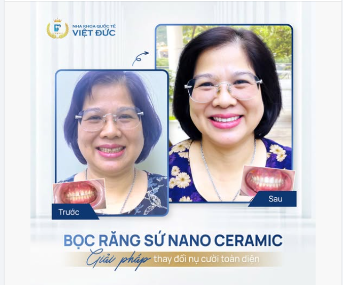 TỪ NỤ CƯỜI E NGẠI ĐẾN RẠNG RỠ TOÀN DIỆN