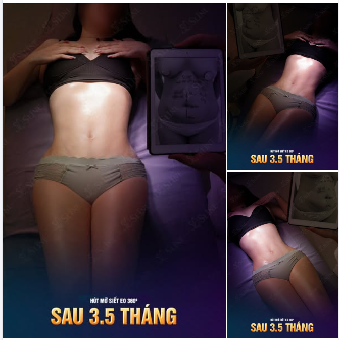CON ĐƯỜNG NGẮN NHẤT ĐỂ CHẠM TỚI “ĐƯỜNG CONG” MƠ ƯỚC?